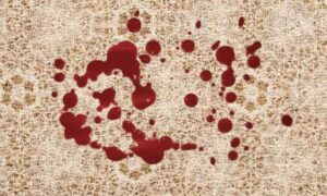 Blood Stain on Lacey Fabric.