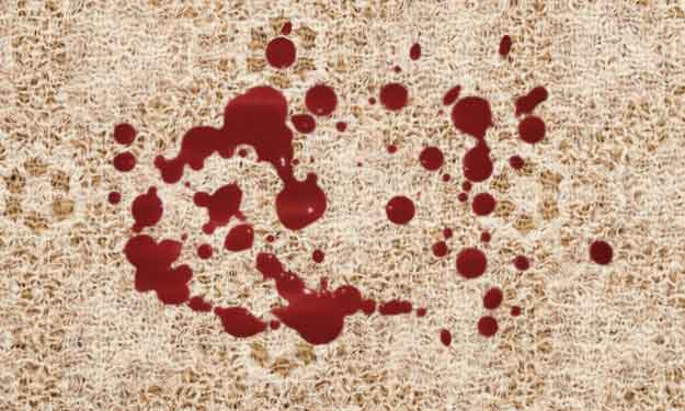 How to Remove Blood Stains from clothing  Blood stain removal, Blood  stains, Deep cleaning tips